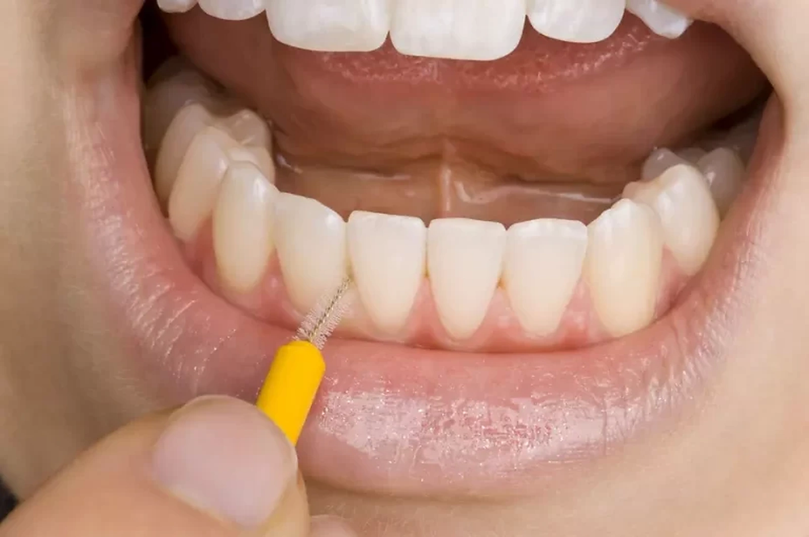 Escova para limpeza interdental